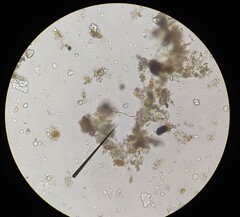 Pseudanabaena galeata