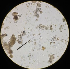 Planktothrix rubescens