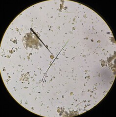 Planktothrix rubescens