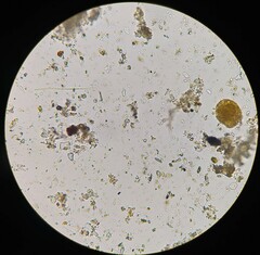 Dolichospermum crassum