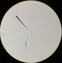 Pseudanabaena galeata