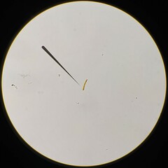 Phormidium autumnale