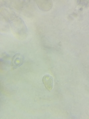 Melanoleuca griseobrunnea