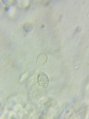 Melanoleuca griseobrunnea