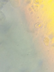 Melanoleuca griseobrunnea