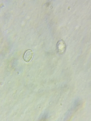 Melanoleuca griseobrunnea