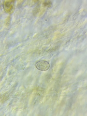 Melanoleuca griseobrunnea