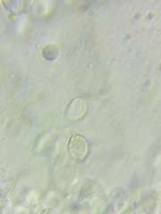 Melanoleuca griseobrunnea