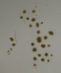 Gloeotrichia echinulata