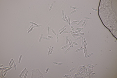Ascochyta boydii