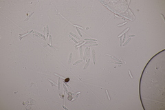 Ascochyta boydii