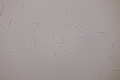 Ascochyta boydii