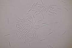 Ascochyta boydii