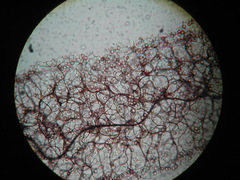 Stemonitopsis hyperopta