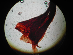 Stemonitopsis hyperopta