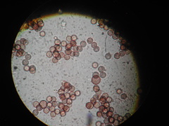 Stemonitopsis hyperopta