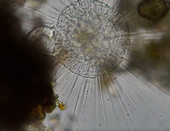 Actinosphaerium eichhornii