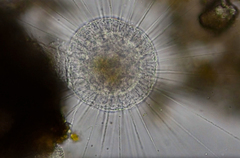 Actinosphaerium eichhornii