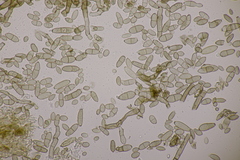 Cladosporium epichloes