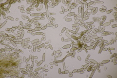 Cladosporium epichloes