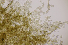 Cladosporium epichloes