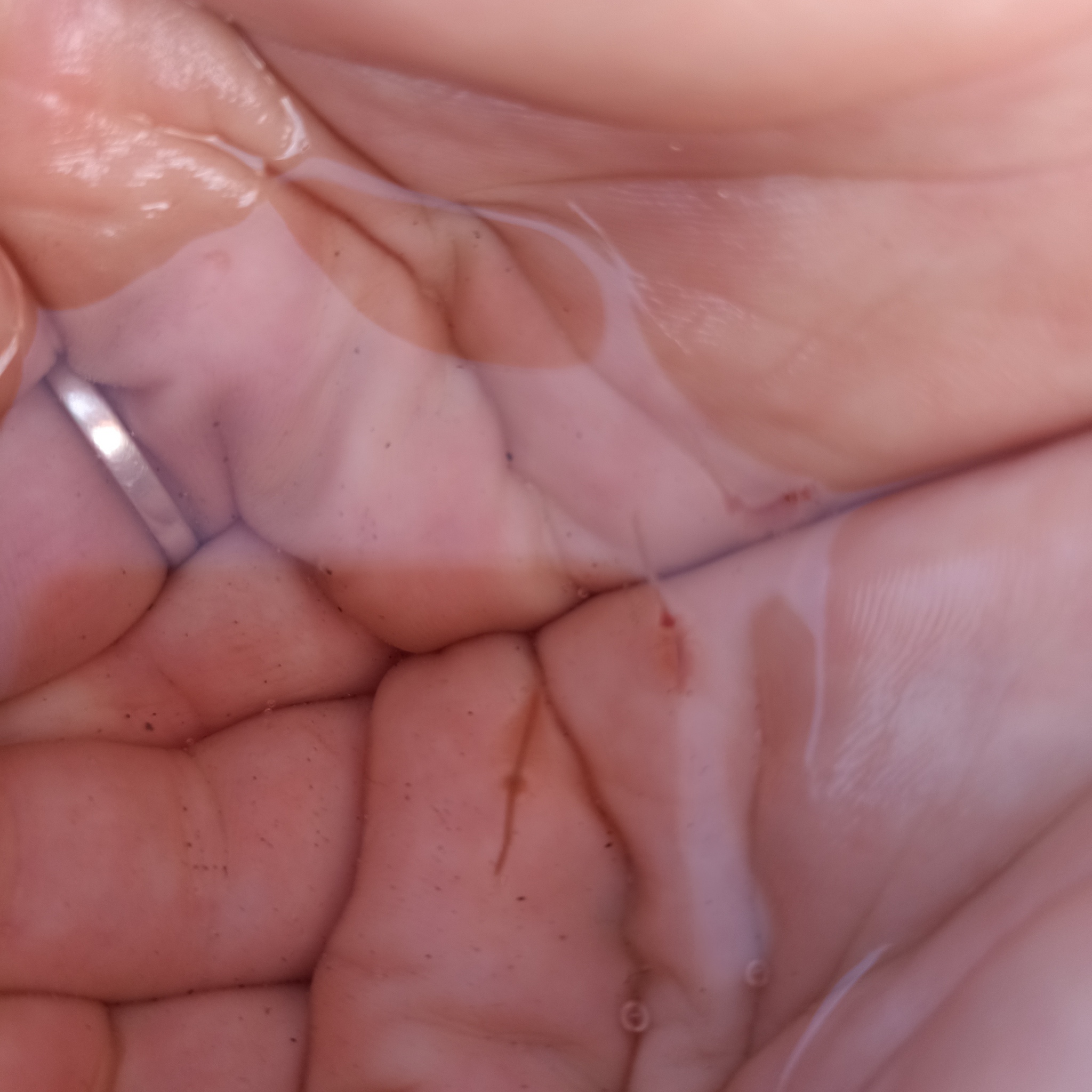 Artemia salina (Linnaeus, 1758)