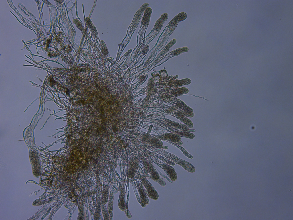 Blastocladiomycota
