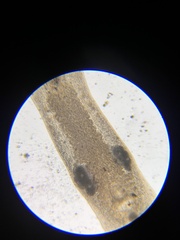 Macrostomum tuba