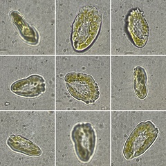Heterosigma akashiwo