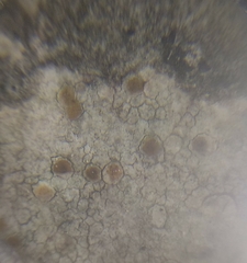 Protoblastenia incrustans