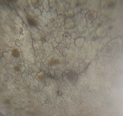 Protoblastenia incrustans