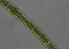 Hyalotheca