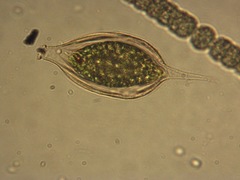 Strombomonas costata