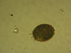 Trachelomonas armata