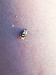 Echinolittorina aspera