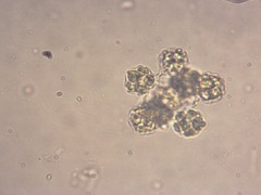 Coelastrum pulchrum