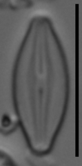 Microcostatus