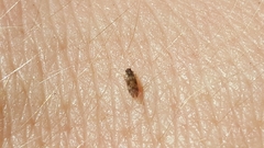 Peripsocus subfasciatus