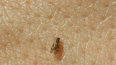 Peripsocus subfasciatus
