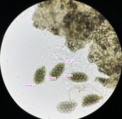 Preussia fleischhakii