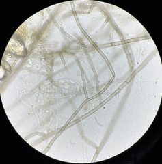 Preussia fleischhakii