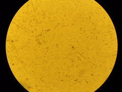 Phaeopezia apiculata