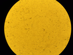 Phaeopezia apiculata