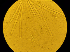 Phaeopezia apiculata