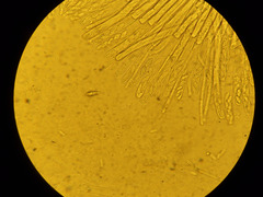 Phaeopezia apiculata