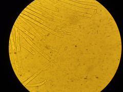 Phaeopezia apiculata