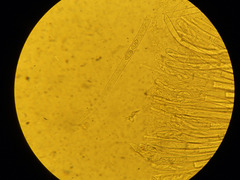 Phaeopezia apiculata