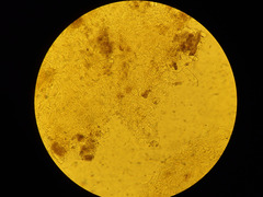 Phaeopezia apiculata