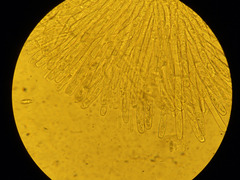 Phaeopezia apiculata