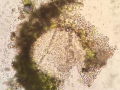 Thelocarpon laureri